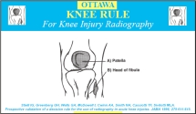 Ottawa Knee Rule PDFs