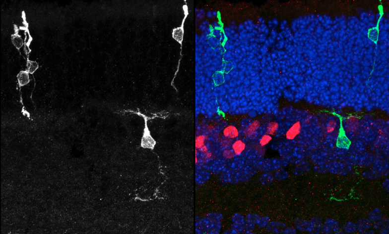 Retroviral clones (green) generated from dividing progenitors transduced at postnatal day 0, and harvested 2 weeks later. Vsx2 protein staining marks bipolar cells (red), while Hoechst stains the DNA (blue), allowing the tissue to be visualized in full. The clone on the left contains 3 rods, while the clone on the right contains a rod and a bipolar cell.