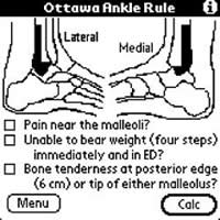 Ottawa Ankle Rules for PDAs