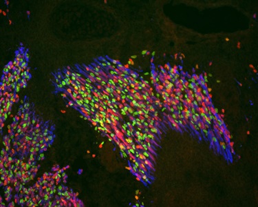 Muscle stem cells. Image by Dr. Fabien LeGrand