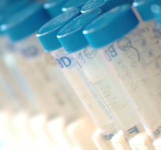 a row of test tubes with blue caps